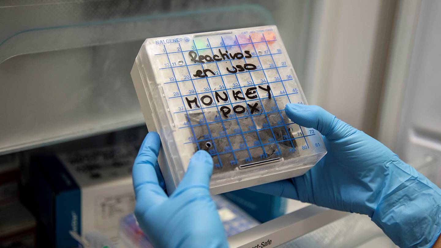Honduras apenas cuenta con 50 pruebas para detectar la enfermedad, dijeron autoridades de Salud.