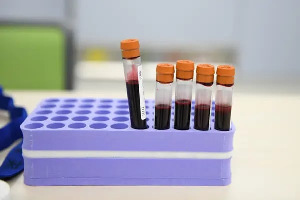 Muestras de sangre en una mesa, durante una prueba de anticuerpos de Covid-19 en el Hospital Universitario de Chiba, Japón, el miércoles 1 de diciembre de 2021.