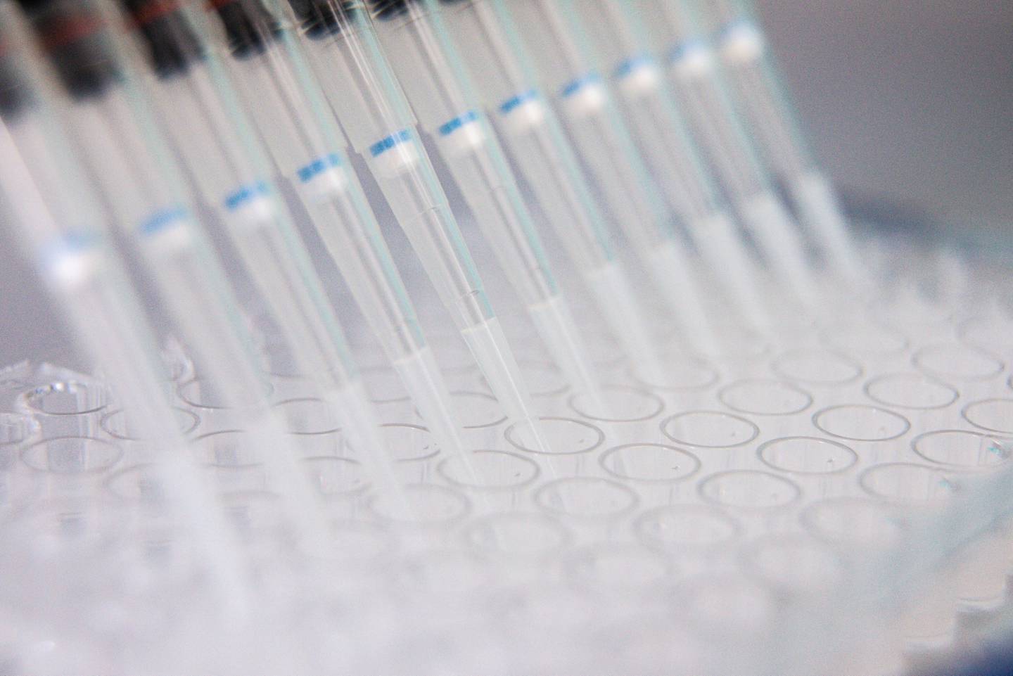 Un técnico de laboratorio utiliza un gotero multicanal durante el proceso de cuantificación de antígenos de la investigación de la vacuna contra el coronavirus en los laboratorios de Valneva SA en Viena, Austria, el jueves 6 de agosto de 2020.  Fotógrafo: Akos Stiller/Bloomberg