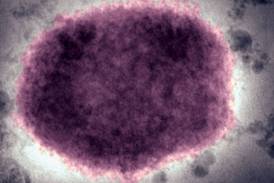 Superar a varíola dos macacos será mais fácil que a covid, dizem especialistas
