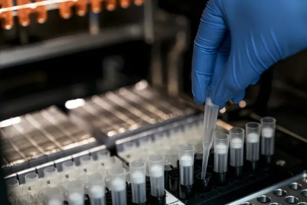 Un técnico prepara muestras de ADN en un laboratorio de análisis en Hong Kong, China, el viernes 26 de enero de 2018.