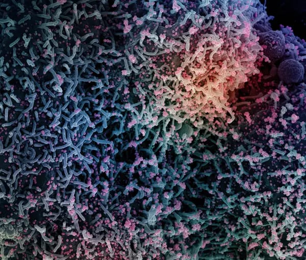 Las células T ayudan a combatir el virus junto a los anticuerpos