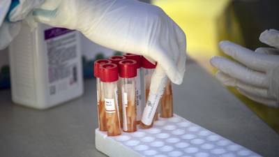 Nuevo estudio dice que la variante ómicron se pudo originar en África Occidentaldfd