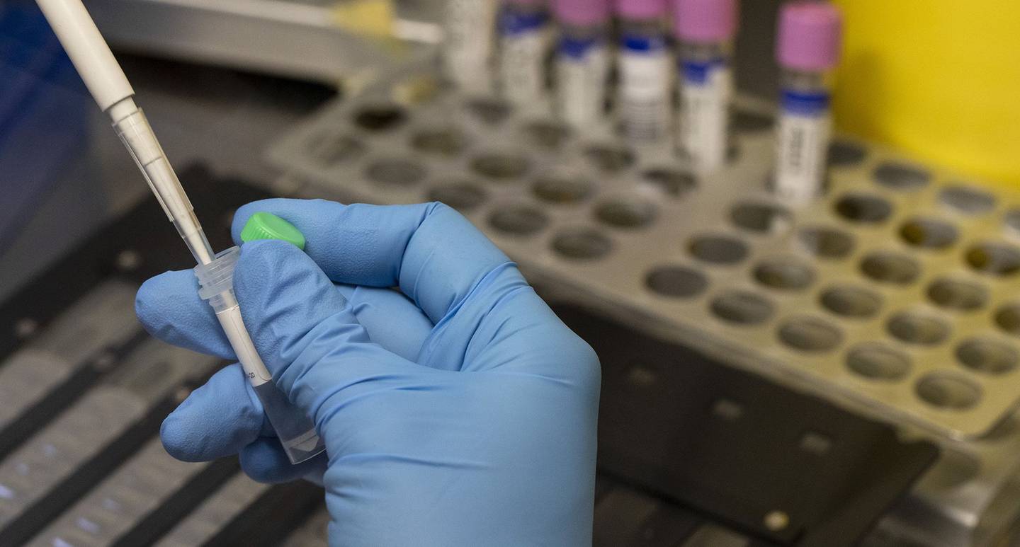 Un técnico de laboratorio médico inactiva muestras sospechosas de viruela del mono para ser analizadas por PCR en el laboratorio de microbiología del Hospital La Paz el 06 de junio de 2022 en Madrid, España.