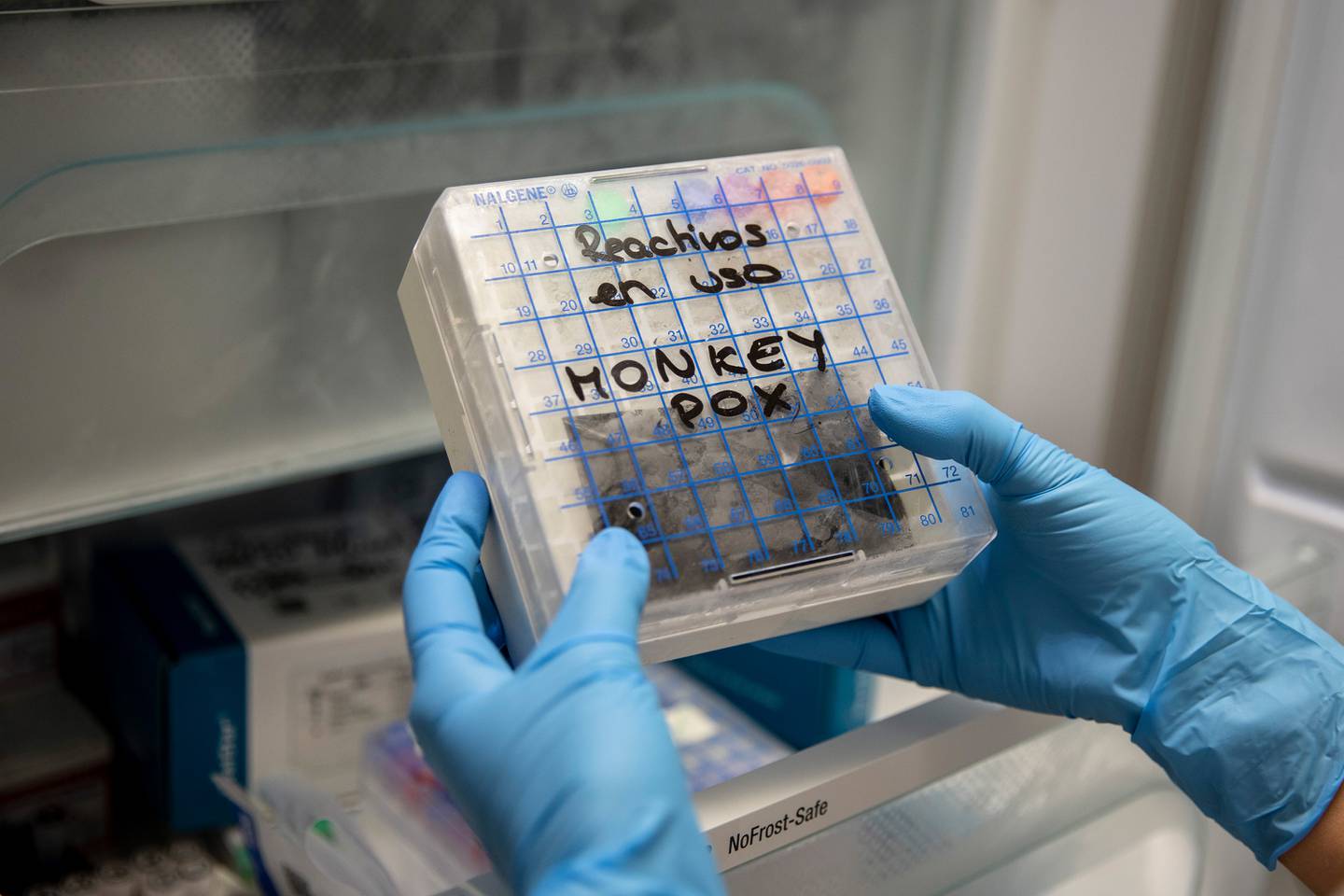 Muestras sospechosas de viruela del mono en un laboratorio de microbiología.Fotógrafo: Pablo Blázquez Domínguez/Getty Images Europa