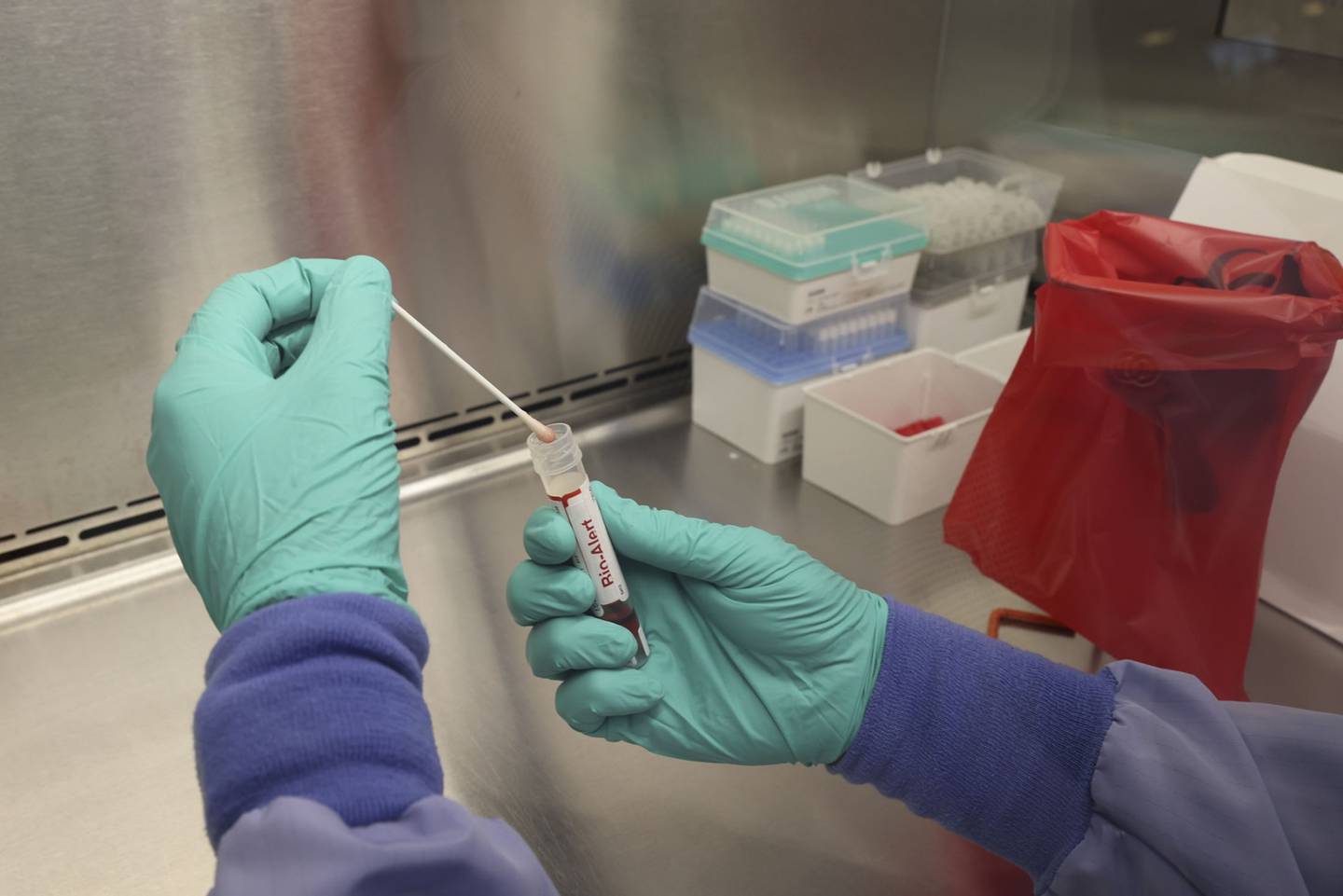 Un hisopado que dio positivo para el virus de la viruela del mono se ve en el Laboratorio de Virología de Medicina de la Universidad de Washington el 12 de julio de 2022 en Seattle, Washington. El Laboratorio de Virología de Medicina de la UW es uno de los pocos laboratorios clínicos de referencia en el país que ofrece pruebas de PCR desarrolladas en laboratorio para la detección del virus de la viruela del mono. (Foto: Karen Ducey/Getty Images)