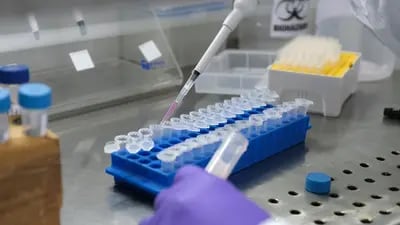 Laboratório faz testes de covid para identificar variantes