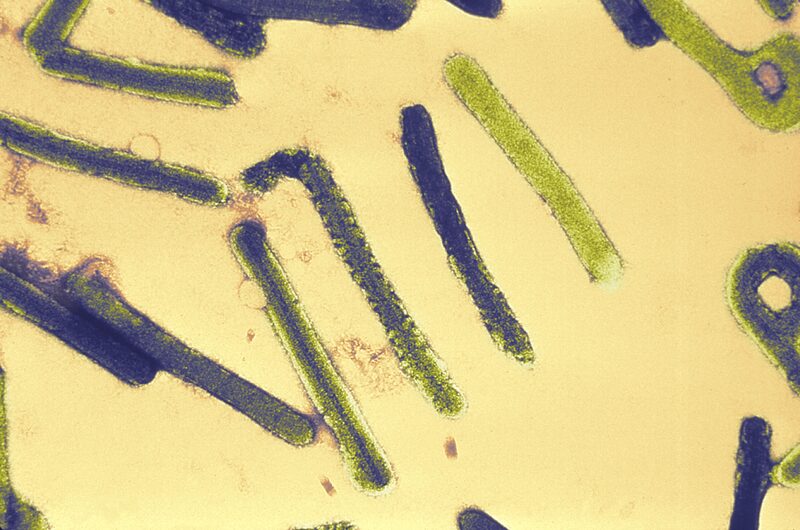 Esta micrografía electrónica muestra varios viriones de Marburgo. Esta micrografía electrónica muestra varios viriones de Marburgo.