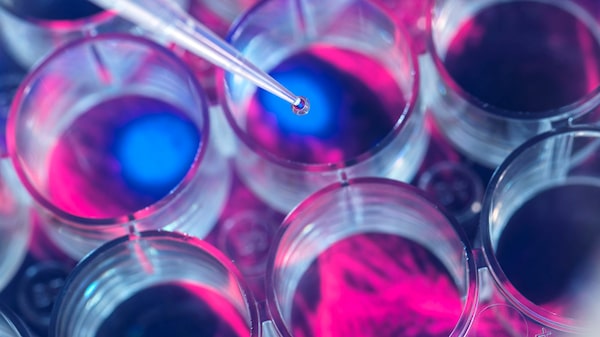 J&J adquirirá Intra-Cellular por unos US$14.600 millones: los detalles J&J adquirirá Intra-Cellular por unos US$14.600 millones: los detalles