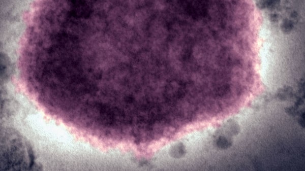 Virus de viruela del mono tiene alrededor de 50 mutaciones, según estudio Virus de viruela del mono tiene alrededor de 50 mutaciones, según estudio