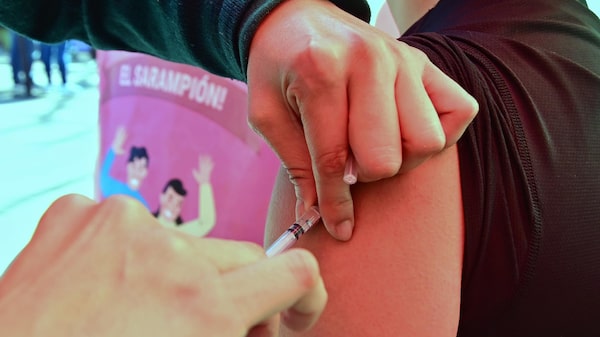 Gobierno de México reporta 28 muertes por brote de sarampión Gobierno de México reporta 28 muertes por brote de sarampión