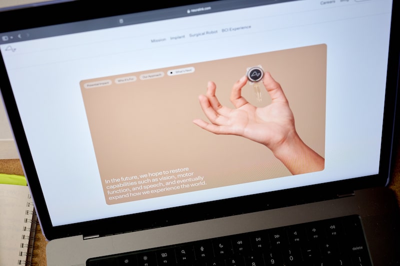 El segundo implante cerebral de Neuralink se realizaría dentro de una semana, dice Elon Musk El segundo implante cerebral de Neuralink se realizaría dentro de una semana, dice Elon Musk