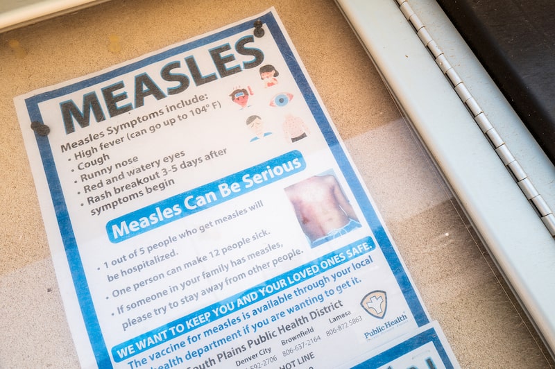 Second Child Dies As Measles Outbreak Continues To Spread In Texas Second Child Dies As Measles Outbreak Continues To Spread In Texas