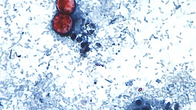 Investigan brote de Cyclospora, un parásito vinculado a diarrea severa, en 31 estados de EE.UU. Investigan brote de Cyclospora, un parásito vinculado a diarrea severa, en 31 estados de EE.UU.