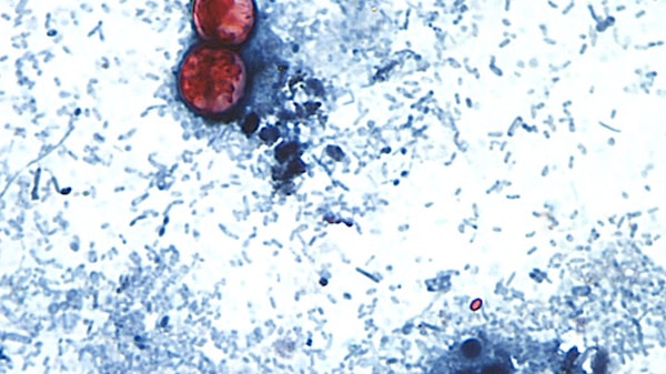Investigan brote de Cyclospora, un parásito vinculado a diarrea severa, en 31 estados de EE.UU. Investigan brote de Cyclospora, un parásito vinculado a diarrea severa, en 31 estados de EE.UU.