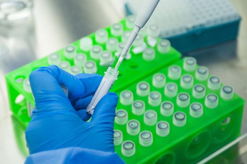 Según una alta funcionaria del Reino Unido, la variante del Covid-19 detectada en Sudáfrica es "la más preocupante" hasta la fecha. Según una alta funcionaria del Reino Unido, la variante del Covid-19 detectada en Sudáfrica es "la más preocupante" hasta la fecha.