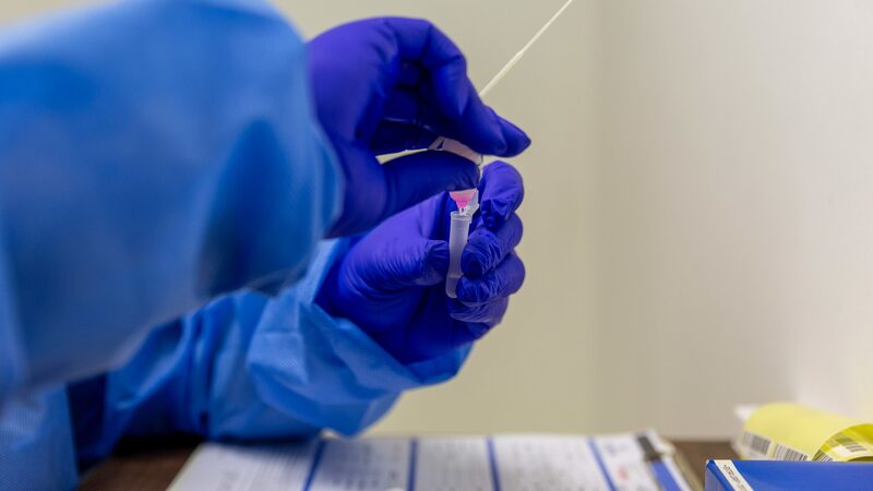 Você tem três vezes mais chances de ser reinfectado pela ômicron Você tem três vezes mais chances de ser reinfectado pela ômicron