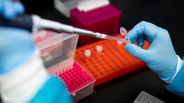 Paciente noruego logra la remisión del VIH tras un trasplante de células madre de su hermano Paciente noruego logra la remisión del VIH tras un trasplante de células madre de su hermano