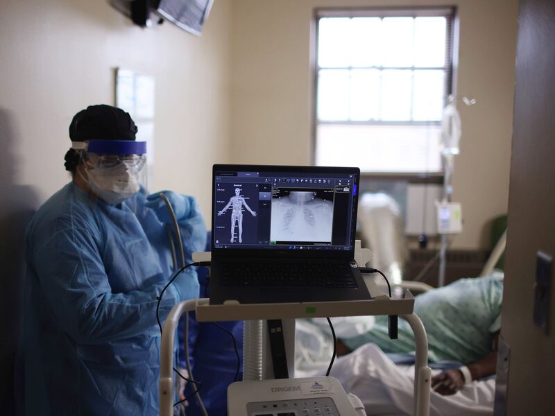 Microcoágulos podrían causar síntomas de Covid-19 prolongado: científicos Microcoágulos podrían causar síntomas de Covid-19 prolongado: científicos