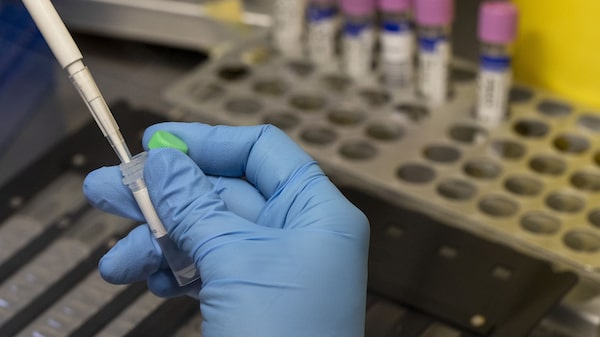 Reino Unido ofrecerá vacuna para controlar propagación de viruela del mono Reino Unido ofrecerá vacuna para controlar propagación de viruela del mono