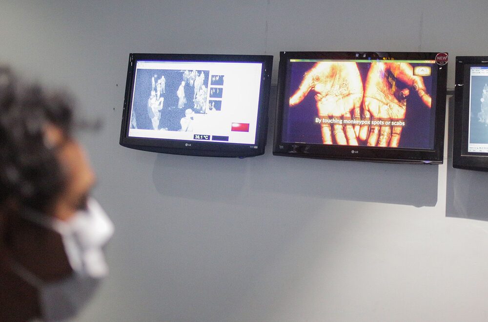 Los países deben prepararse para más casos de la viruela del mono, infección que se produce por el contacto estrecho entre personas. Los países deben prepararse para más casos de la viruela del mono, infección que se produce por el contacto estrecho entre personas.