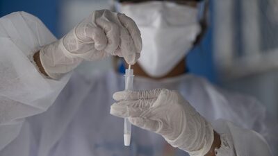 Testes de clínicas privadas mostram avanço da ômicron no Brasil Testes de clínicas privadas mostram avanço da ômicron no Brasil