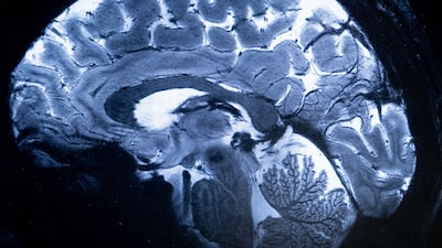 China avanza en la carrera de implantes cerebrales y secunda a EE.UU. en fase de control China avanza en la carrera de implantes cerebrales y secunda a EE.UU. en fase de control