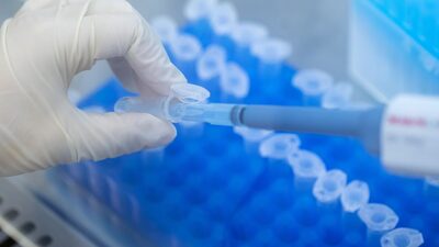 Dasa reforça foco no ‘lab to lab’ em expansão em diagnósticos, diz executivo Dasa reforça foco no ‘lab to lab’ em expansão em diagnósticos, diz executivo