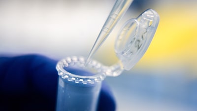 Detectan en murciélagos de Brasil un coronavirus con rasgos similares a los del Covid y MERS Detectan en murciélagos de Brasil un coronavirus con rasgos similares a los del Covid y MERS