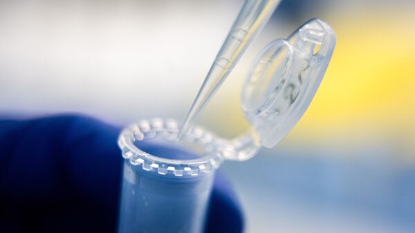 Detectan en murciélagos de Brasil un coronavirus con rasgos similares a los del Covid y MERS Detectan en murciélagos de Brasil un coronavirus con rasgos similares a los del Covid y MERS