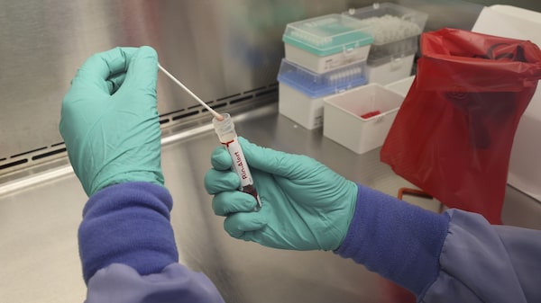 EE.UU. aprueba técnica de emergencia que amplía acceso a vacuna contra viruela símica EE.UU. aprueba técnica de emergencia que amplía acceso a vacuna contra viruela símica