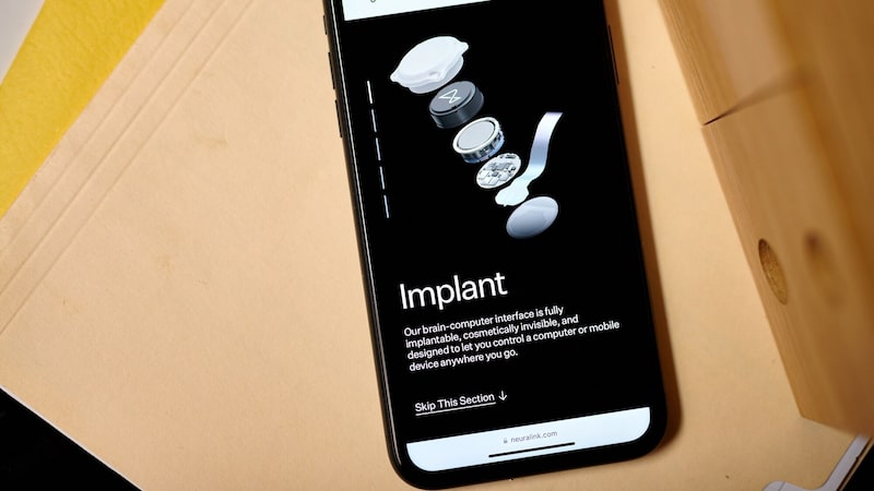 Neuralink implanta chip cerebral em terceiro paciente, diz Musk Neuralink implanta chip cerebral em terceiro paciente, diz Musk