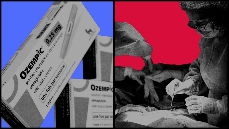 Los cirujanos plásticos están realizando más abdominoplastias, lifting de muslos y rellenos faciales para personas que han perdido peso con fármacos como Ozempic y Wegovy. Los cirujanos plásticos están realizando más abdominoplastias, lifting de muslos y rellenos faciales para personas que han perdido peso con fármacos como Ozempic y Wegovy.