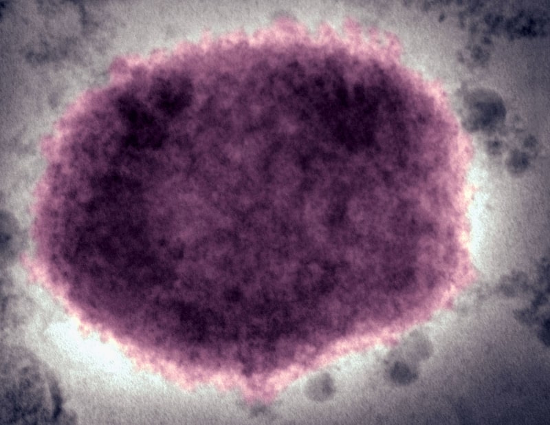 Virus de la viruela del mono en fluido vesicular humano Virus de la viruela del mono en fluido vesicular humano
