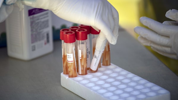 Las características de las nuevas subvariantes de ómicron que preocupan a la OMS Las características de las nuevas subvariantes de ómicron que preocupan a la OMS