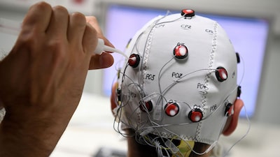 China aprueba el primer implante cerebral para uso comercial China aprueba el primer implante cerebral para uso comercial