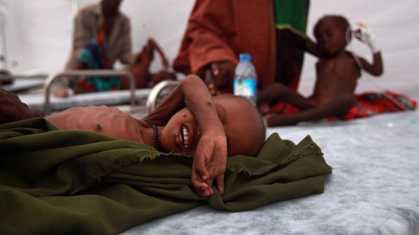 Mundo está perdiendo la batalla para acabar con el hambre para finales de la década Mundo está perdiendo la batalla para acabar con el hambre para finales de la década