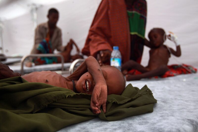 Niños somalíes reciben tratamiento médico en un hospital de campaña turco el 19 de agosto de 2011 en Mogadiscio, Somalia. Niños somalíes reciben tratamiento médico en un hospital de campaña turco el 19 de agosto de 2011 en Mogadiscio, Somalia.