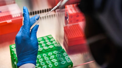 Virus Nipah: síntomas, contagio y países donde ya está el brote además de India Virus Nipah: síntomas, contagio y países donde ya está el brote además de India