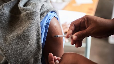 Del 71 al 81: Estas son las personas obligadas a vacunarse contra el sarampión en Chile Del 71 al 81: Estas son las personas obligadas a vacunarse contra el sarampión en Chile