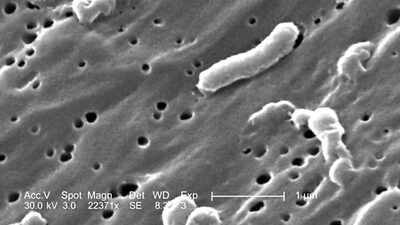 Universidade de Wuhan identifica caso de cólera e gera temores de disseminação Universidade de Wuhan identifica caso de cólera e gera temores de disseminação