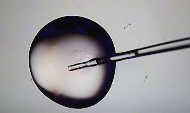 Imagen microscópica de una solución criogénica durante la preparación de embriones en un laboratorio de fecundación in vitro. Imagen microscópica de una solución criogénica durante la preparación de embriones en un laboratorio de fecundación in vitro.