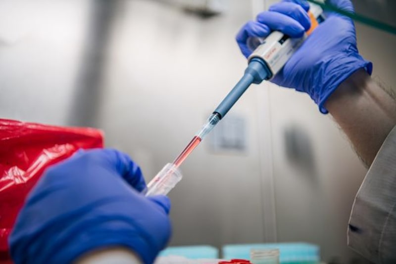 Técnico de laboratorio Julio Vásquez aísla muestras de Covid-19, en el laboratorio de Genview Diagnosis, el 13 de agosto de 2021 en Houston, Texas. Técnico de laboratorio Julio Vásquez aísla muestras de Covid-19, en el laboratorio de Genview Diagnosis, el 13 de agosto de 2021 en Houston, Texas.