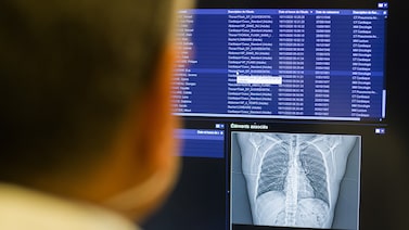 Startup de IA para diagnóstico de câncer aposta no Brasil e vai investir US$ 11 milhões Startup de IA para diagnóstico de câncer aposta no Brasil e vai investir US$ 11 milhões